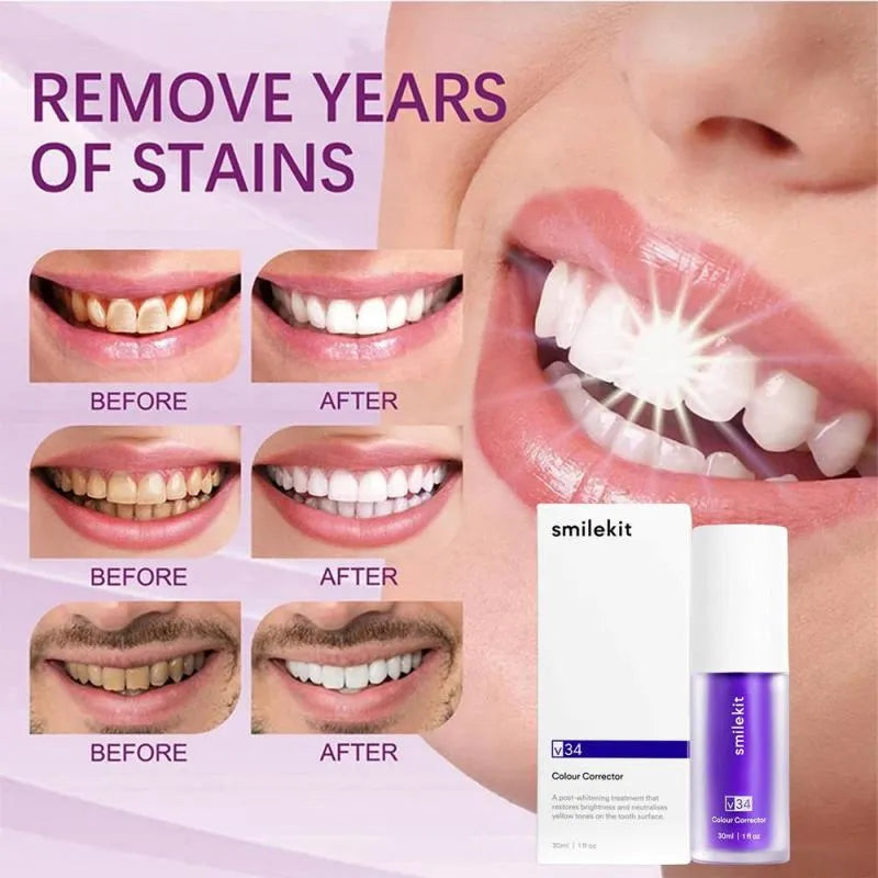 Hismile V34 Purple Whitening Toothpaste Remove Stains Reduce Yellowing Care For Teeth Gums Fresh Breath Brightening Teeth